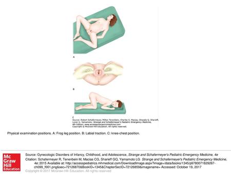 Physical examination positions. A: Frog leg position