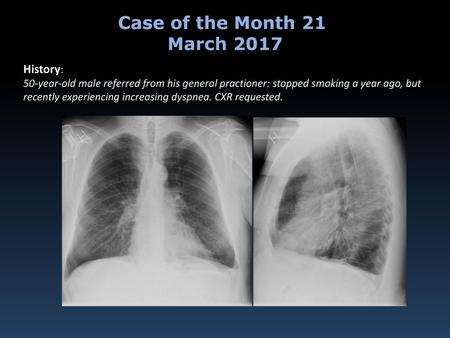 Case of the Month 21 March 2017 History: