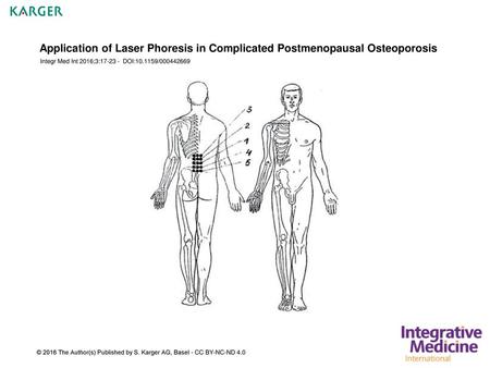 Application of Laser Phoresis in Complicated Postmenopausal Osteoporosis Integr Med Int 2016;3:17-23 - DOI:10.1159/000442669 Fig. 1. Zones of laser phoresis: