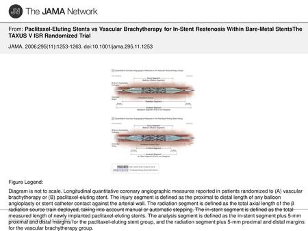 From: Paclitaxel-Eluting Stents vs Vascular Brachytherapy for In-Stent Restenosis Within Bare-Metal StentsThe TAXUS V ISR Randomized Trial JAMA. 2006;295(11):1253-1263.