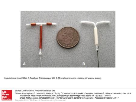 Intrauterine devices (IUDs). A. ParaGard T 380A copper IUD. B