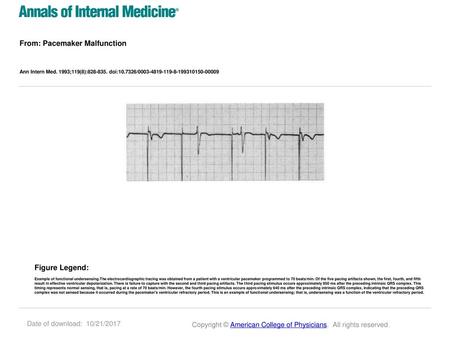 From: Pacemaker Malfunction