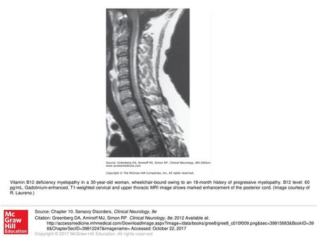 Vitamin B12 deficiency myelopathy in a 30-year-old woman, wheelchair-bound owing to an 18-month history of progressive myelopathy. B12 level: 60 pg/mL.