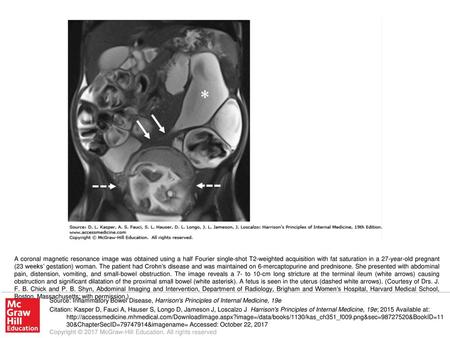 A coronal magnetic resonance image was obtained using a half Fourier single-shot T2-weighted acquisition with fat saturation in a 27-year-old pregnant.