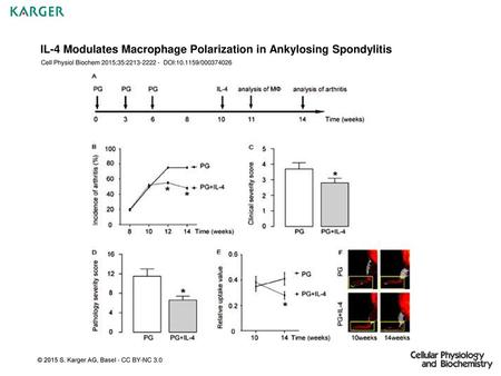 IL-4 Modulates Macrophage Polarization in Ankylosing Spondylitis