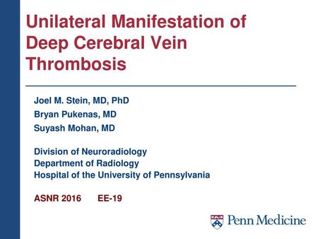 Unilateral Manifestation of Deep Cerebral Vein Thrombosis