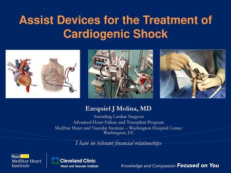 Assist Devices for the Treatment of Cardiogenic Shock