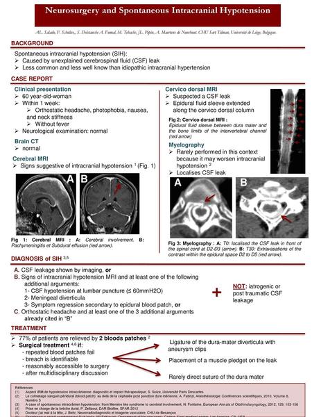 Neurosurgery and Spontaneous Intracranial Hypotension