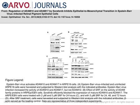 From: Regulation of ADAM10 and ADAM17 by Sorafenib Inhibits Epithelial-to-Mesenchymal Transition in Epstein-Barr Virus–Infected Retinal Pigment Epithelial.