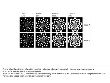 Figure 1 The pattern reversal stimuli