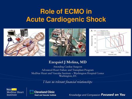 Role of ECMO in Acute Cardiogenic Shock
