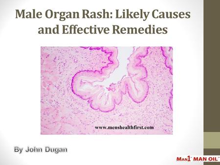 Male Organ Rash: Likely Causes and Effective Remedies