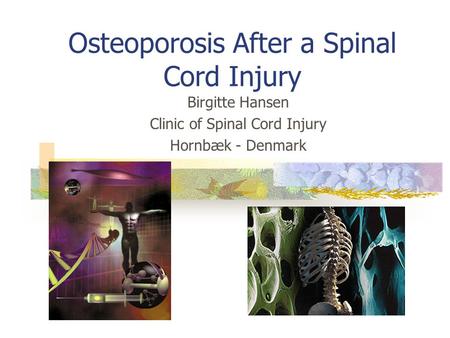Osteoporosis After a Spinal Cord Injury