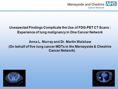 Unexpected Findings Complicate the Use of FDG-PET CT Scans : Experience of lung malignancy in One Cancer Network Anna L. Murray and Dr. Martin Walshaw.