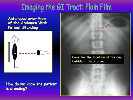 Imaging the GI Tract: Plain Film