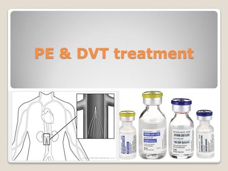 PE & DVT treatment. Classification of Emboli - Fat and Marrow ◦Sequelae from any marrow/adipose injury ◦fat and cells are released into bloodstream ◦CPR,