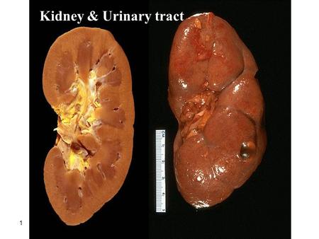 Kidney & Urinary tract.