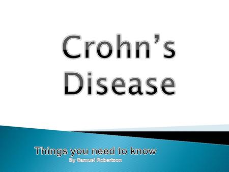 Crohn’s Disease Things you need to know By Samuel Robertson.