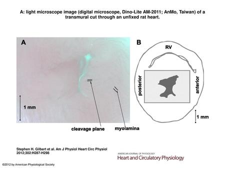A: light microscope image (digital microscope, Dino-Lite AM-2011; AnMo, Taiwan) of a transmural cut through an unfixed rat heart. A: light microscope image.