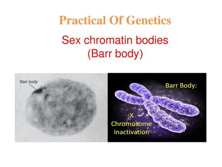 Sex chromatin bodies ((Barr body
