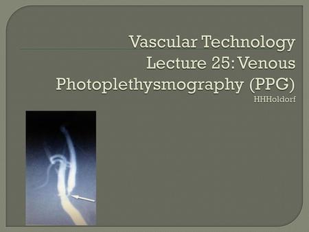 Photo-Plethysmography