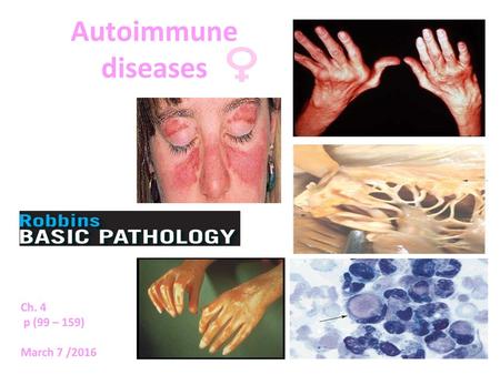 Autoimmune diseases Ch. 4 p (99 – 159) March 7 /2016 March.6.2016.