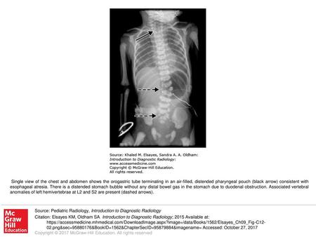 Radiology images of surgical conditions/congenital anomalies - ppt download