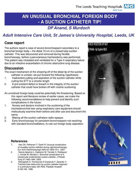 AN UNUSUAL BRONCHIAL FOREIGN BODY - A SUCTION CATHETER TIP!