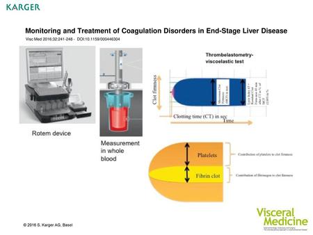 Monitoring and Treatment of Coagulation Disorders in End-Stage Liver Disease Visc Med 2016;32:241-248 - DOI:10.1159/000446304 Fig. 1. On the left side,