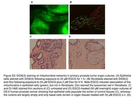 A		 B C 		 D Figure S3: DiO6(3) staining of mitochondrial networks in primary prostate tumor organ cultures. (A) Epithelial.