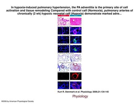 In hypoxia-induced pulmonary hypertension, the PA adventitia is the primary site of cell activation and tissue remodeling Compared with control calf (Normoxia),