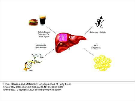 From: Causes and Metabolic Consequences of Fatty Liver