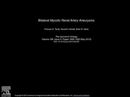 Bilateral Mycotic Renal Artery Aneurysms