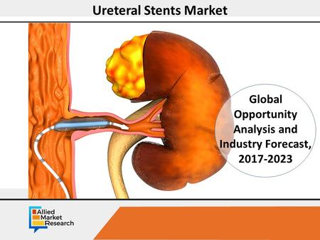 Opportunity Analysis and Industry Forecast, Ureteral Stents Market Global Opportunity Analysis and Industry Forecast,