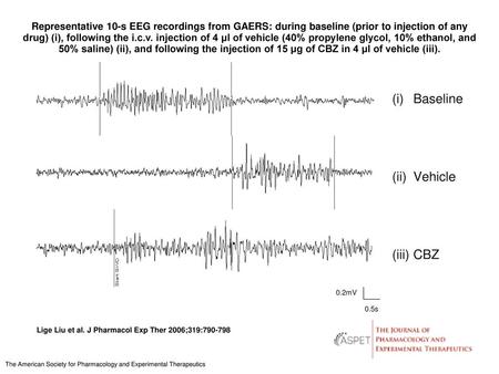 Representative 10-s EEG recordings from GAERS: during baseline (prior to injection of any drug) (i), following the i.c.v. injection of 4 μl of vehicle.