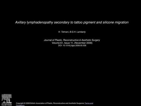 Axillary lymphadenopathy secondary to tattoo pigment and silicone migration  H. Tehrani, B.G.H. Lamberty  Journal of Plastic, Reconstructive & Aesthetic.