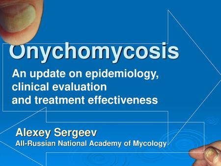 Onychomycosis An update on epidemiology, clinical evaluation