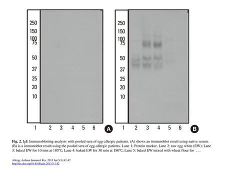 Fig. 2. IgE Immunoblotting analysis with pooled sera of egg-allergic patients. (A) shows an immunoblot result using native serum. (B) is a immunoblot result.