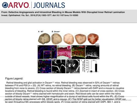 From: Defective Angiogenesis and Intraretinal Bleeding in Mouse Models With Disrupted Inner Retinal Lamination Invest. Ophthalmol. Vis. Sci.. 2016;57(4):1563-1577.