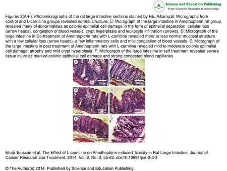 Figures 2(A-F). Photomicrographs of the rat large intestine sections stained by HE. A&B: Micrographs from control and L-carnitine groups revealed normal.