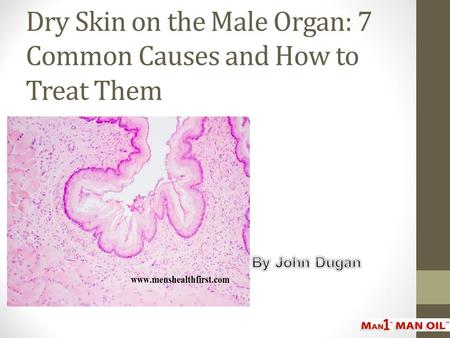 Dry Skin on the Male Organ: 7 Common Causes and How to Treat Them