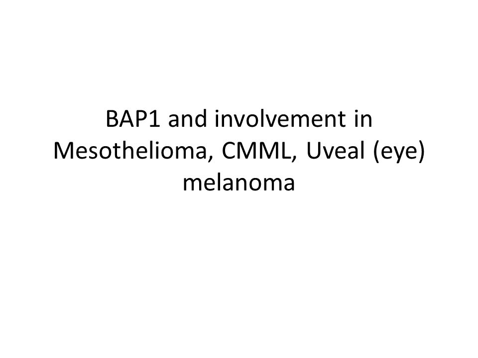 mesotheliomahelioma causes