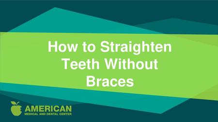 How to Straighten Teeth Without Braces