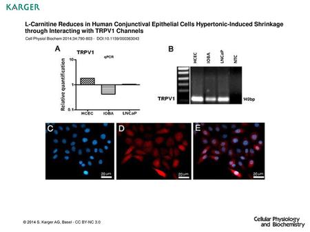 L-Carnitine Reduces in Human Conjunctival Epithelial Cells Hypertonic-Induced Shrinkage through Interacting with TRPV1 Channels Cell Physiol Biochem 2014;34:790-803.