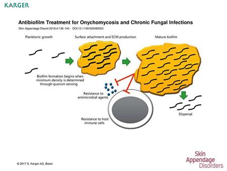 Antibiofilm Treatment for Onychomycosis and Chronic Fungal Infections