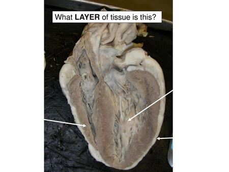 What LAYER of tissue is this?