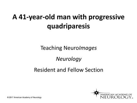 A 41-year-old man with progressive quadriparesis