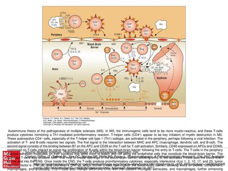 Autoimmune theory of the pathogenesis of multiple sclerosis (MS)