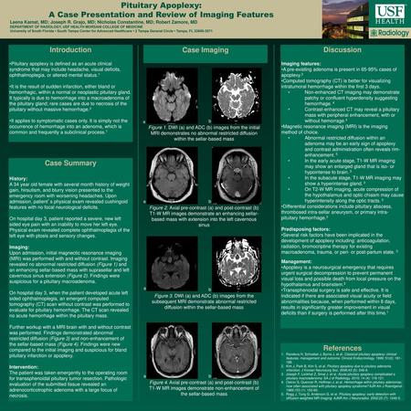 A Case Presentation and Review of Imaging Features
