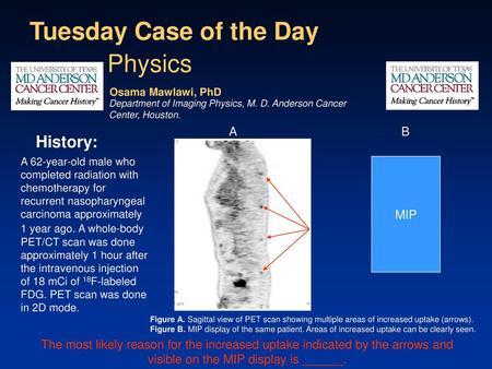 Tuesday Case of the Day Physics History: A B MIP